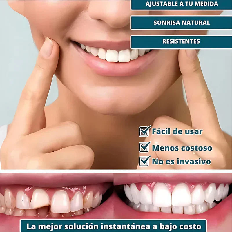 🦷 SmilePerfect™ | Carillas Dentales Ajustables de Resina + Estuche de Regalo 🎁 | ¡Últimas unidades!