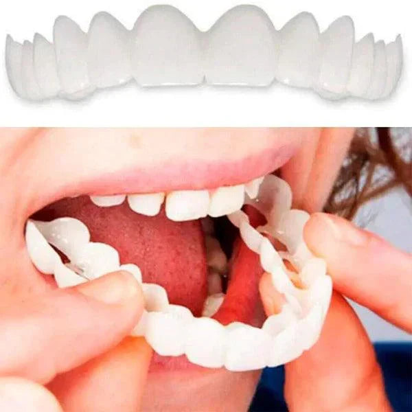 🦷 SmilePerfect™ | Carillas Dentales Ajustables de Resina + Estuche de Regalo 🎁 | ¡Últimas unidades!